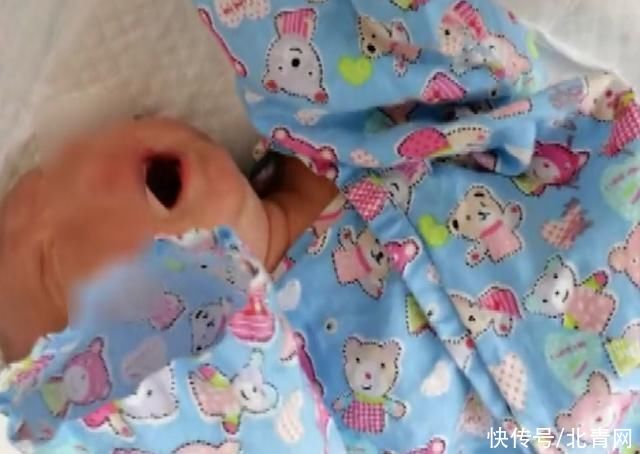 章樱|罕见！杭州一女宝宝出生时口含“龙珠”！竟是……