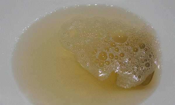 医生|痛风大多是“拖”出来的，医生：出现“2多2疼”，赶紧调理