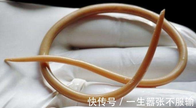 家长们|小孩子身上出现这四种症状,可能是有蛔虫了,作为家长们要注意