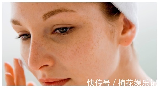 子宫|女性有没有妇科病,看脸就知道!希望你没有这4个表现!