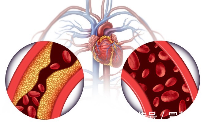 减寿|久坐1小时=抽烟2根=减寿22分钟!坐多久算久坐一文详解