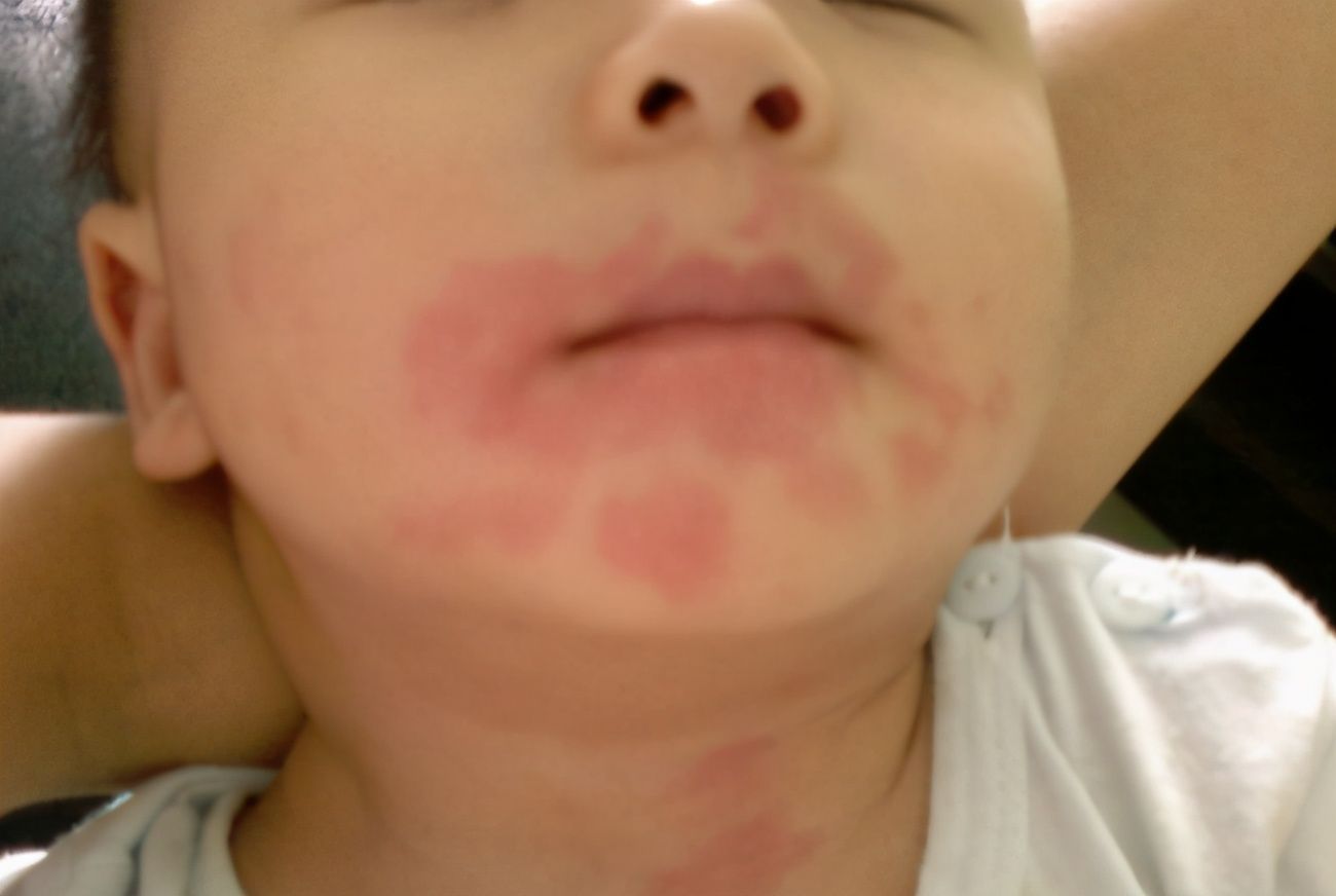 辅食界|鸡蛋羹是辅食界的大众餐,为啥少给宝宝吃?听听儿科医生怎么说