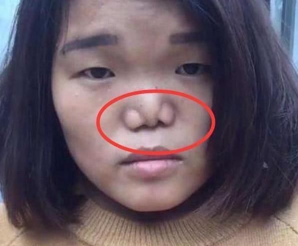 高鼻梁|女孩将这“3动作”当习惯,鼻子会越来越立体,连校花也会羡慕你