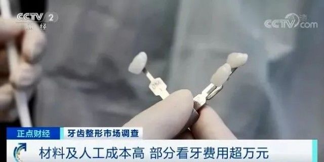 口腔|“整牙热”再次掀起：一颗牙要2万元，为啥这么贵？