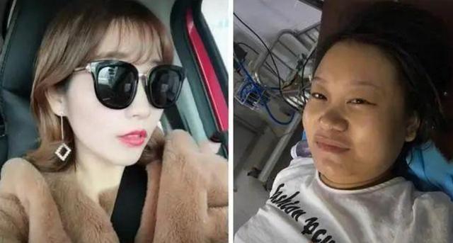 带娃|女性“产前产后对比图”火了,6个变化让网友心疼:为母不易!