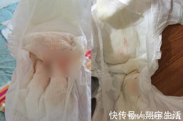 宝宝|新生儿双脚大面积蜕皮，宝妈火急火燎跑医院，医生看到却很淡定