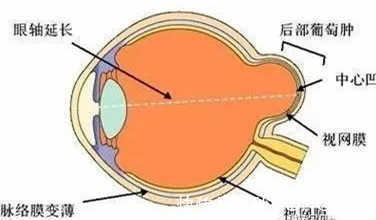 家长们|保护视力，拒绝近视！家长们看这里！
