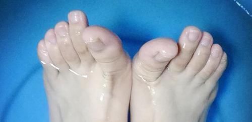 男性用盐水泡脚能养肾,但要注意泡脚禁忌,不然泡了或也白泡