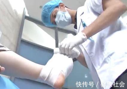 女性 爱穿高跟鞋的女性一定要小心,拇指外翻堪比“裹脚”!不可忽视