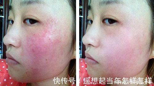 敏感肌|“年薪20万”的人用什么面霜HR、海蓝之谜很常见,后2款没听过