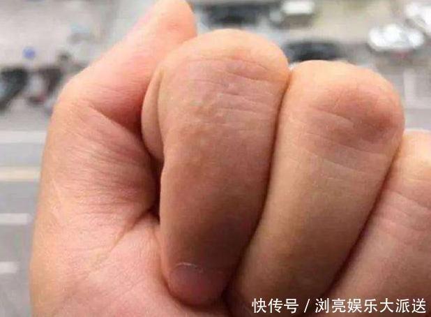 湿气重的人,身体会有5种表现,健康祛湿,教你五招