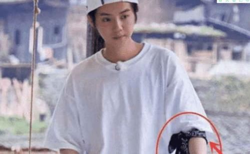 粉丝|有纹身不能上节目? 明星们各显神通, 林心如贴创可贴, 而吴尊简单粗暴