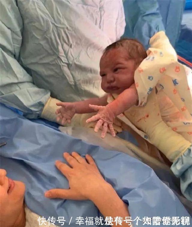 心灵感应|最“社会”宝宝:自带“迎接仪式”出生,大场面“乐翻”医生