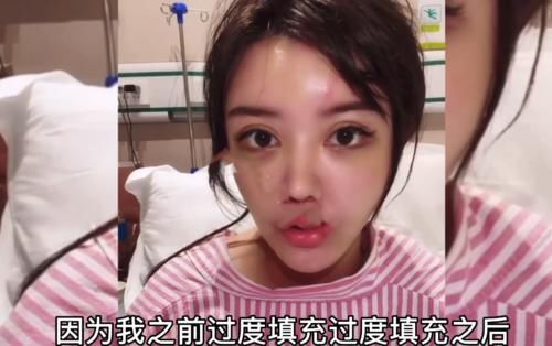 面部|22岁韩安冉面部下垂，多次修复鼻子再无法动刀，越整越像“僵尸脸”