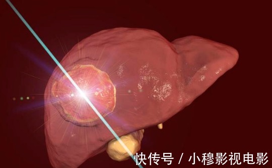 肝病|为何“肝病”越来越多?劝你,3件事不控制,会使肝脏病变