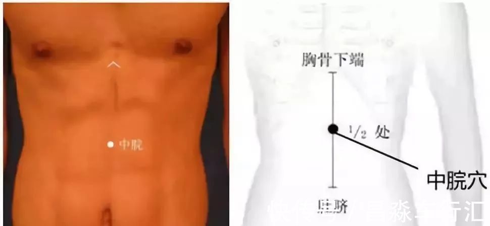 癌变|大家好!我叫“息肉”,癌症的近亲!我最怕无情又温柔的手术刀：艾灸