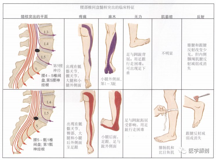 脊髓与脊神经|奈特解剖图谱 | 解剖图谱