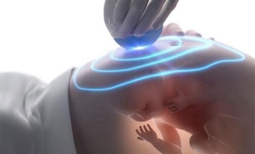 产检|为啥很多产妇不愿意“产检”背后三个现实原因,每一个都很扎心