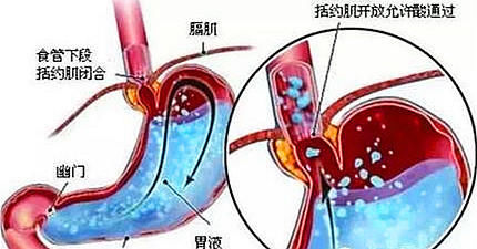 回事|查3次心脏都没问题呀，老胸痛，怎么回事？告诉你也许问题在这里
