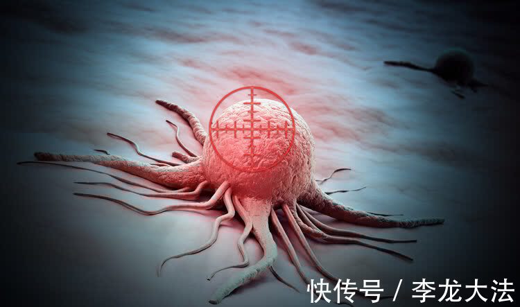 肺癌|癌症是如何转移的?好心提醒:癌症脑转移时,身体常有4种异常