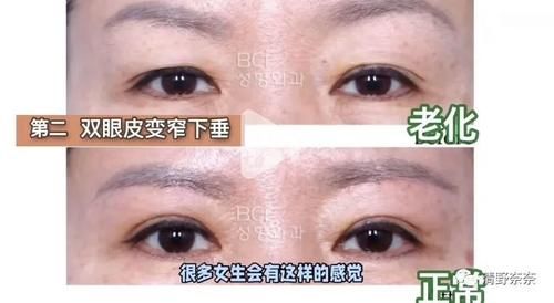 这些变化代表你老了!韩国女生最怕的5个老化现象