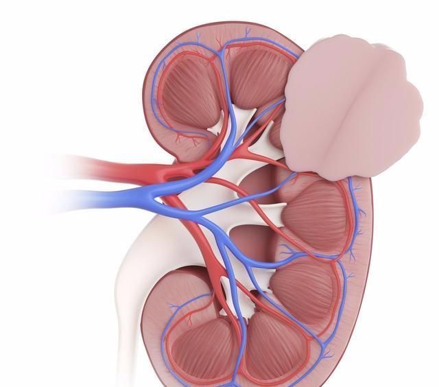 胰岛素|二甲双胍单用效果不理想?给你3种联用方案,降糖效果加倍