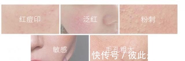 不起眼|我国有一款“不起眼”洁面皂，能控油除螨去黑头，却因价低被忽视