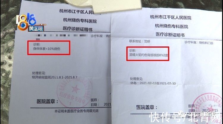 朱老板|姑娘拔火罐，后背起了火