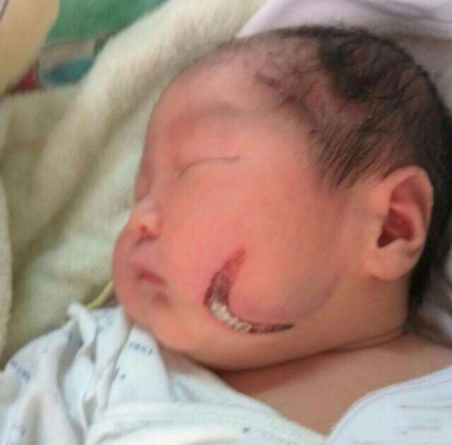 宝宝|女子发现宝宝脸有镰刀痕,去医院医生告知不是病,看完监控报了警