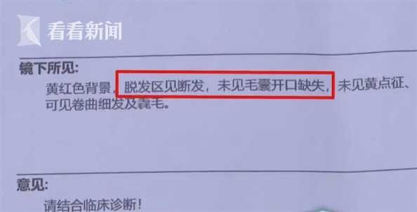 伍号|女子理发店做美发 回家之后傻眼 头顶直接秃了