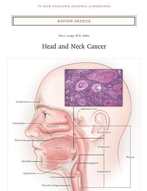 乳头瘤病毒|奥斯卡影帝患上喉癌！七成喉癌与HPV有关，有些原因难以启齿？