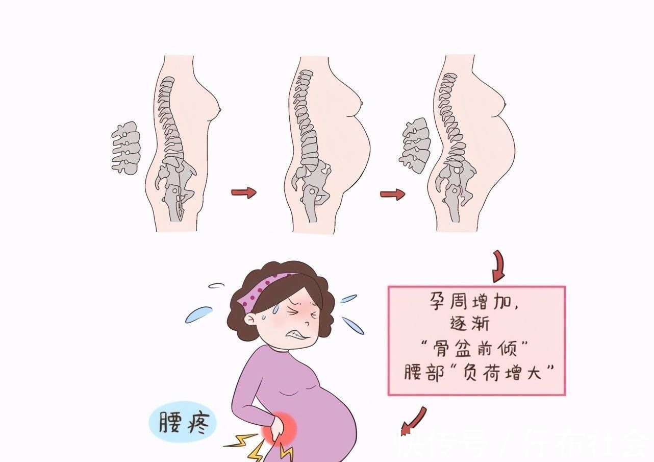 孕妈|孕期里,除了肚子,这四个部位也要“重点保护”,孕妈别大意