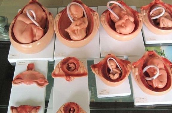 鉴定|怀孕8个月,老婆就生下了宝宝,丈夫:这是亲生的?