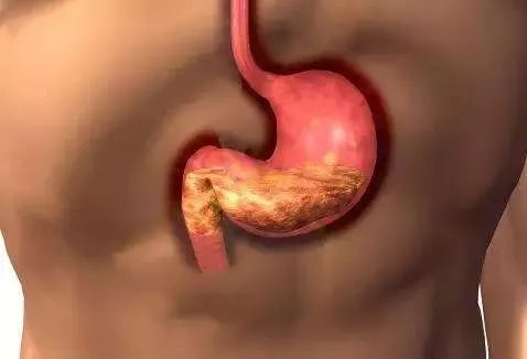 蒲公英|自己“晒干”的蒲公英,能当茶泡水喝吗有什么“禁忌”吗