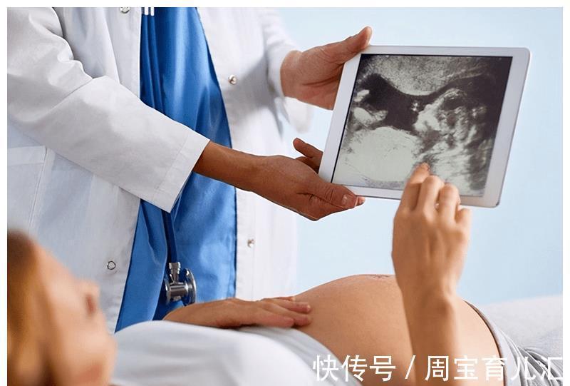 怀孕|怀孕3个月胎儿成形了吗?需要注意哪些问题?
