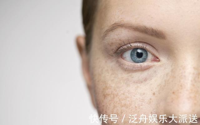 肝脂|37岁女子,满脸黄褐斑,竟查出肝炎,提醒5个表现或是肝病前兆