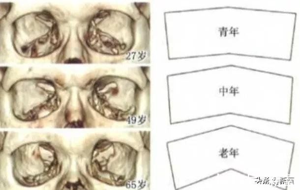 眼部|根据眼眶结构来判断和修正自己的眼部光影美感