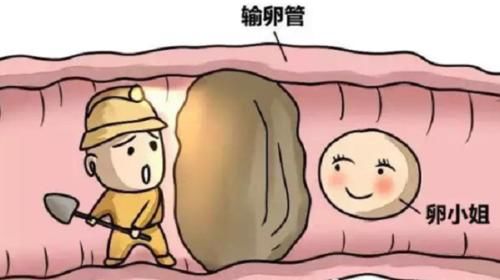 种人|宫外孕很可怕，这6种人最容易被盯上，看看有没有你！