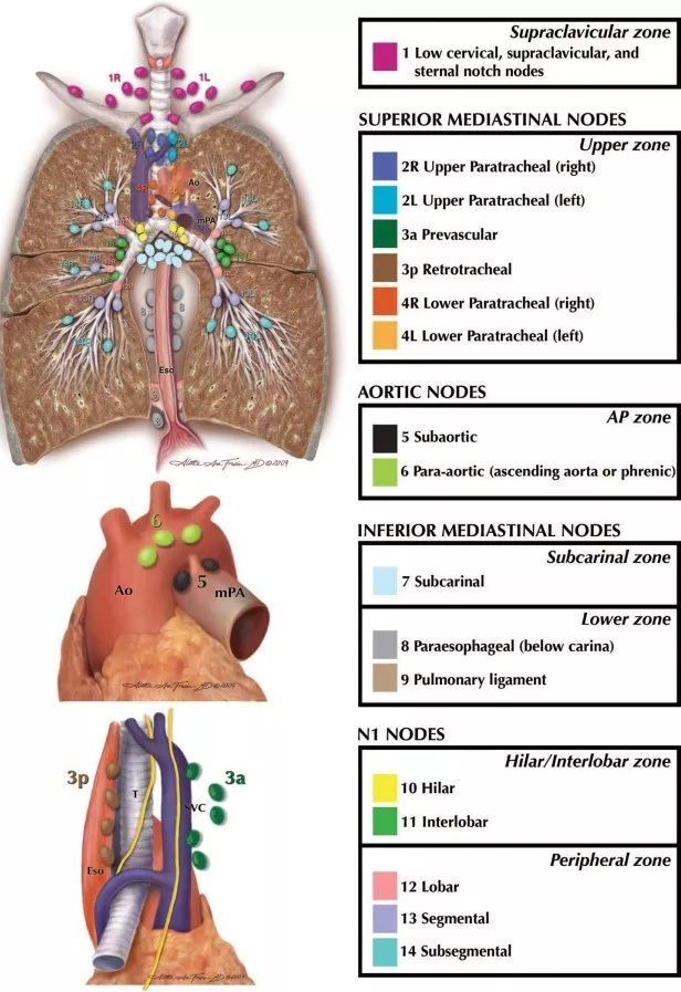 胸骨柄|重要图文：纵隔淋巴结的分区(IASLC)
