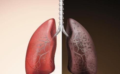 吸烟|人一旦戒烟，就会得各种大病，这是真的吗？早知早受益！