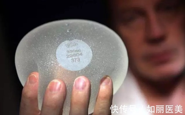 化疗|这样的隆胸假体,可能会致癌?连许多医生都不知道!