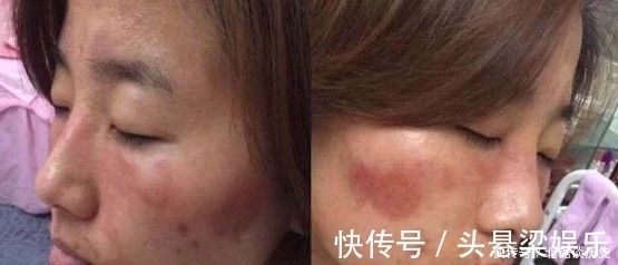 角质层|要想皮肤好，不仅要让肌肤垃圾代谢出去，更要让肌肤吸收好！