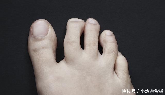 男性肾好,会有这些表现,若占一个,也值得高兴