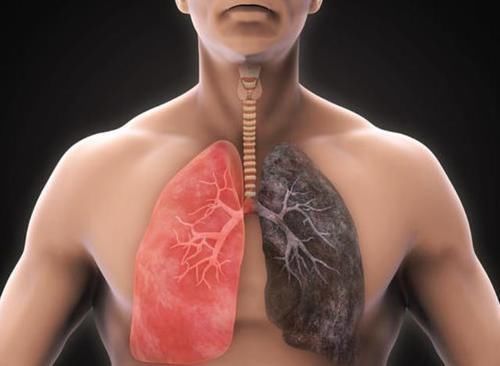 肺部|呼吸内科主任:水里放一勺它,不出一月,肺干净,咳嗽痰多全扫光