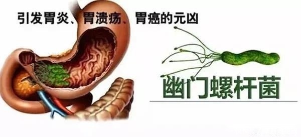  感染|正确使用筷子，关乎一家人的健康从选对、洗对、放对筷子开始