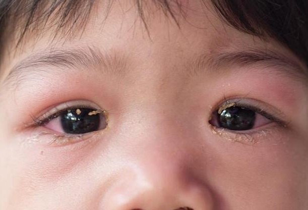 滋补品|9岁男孩脾虚大半年不长个,听取儿科主任建议,半年长高8公分