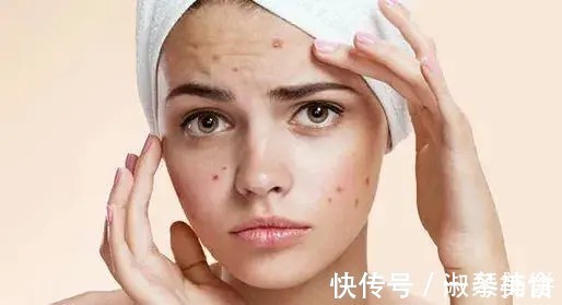 系列|坏脸系列：十二个变丑作死的坏习惯，姐妹中招了吗？对号入座哦