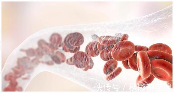 三酰甘油|血脂高的人,别怕,这3种食物,坚持早晚吃一点,血脂慢慢降下去