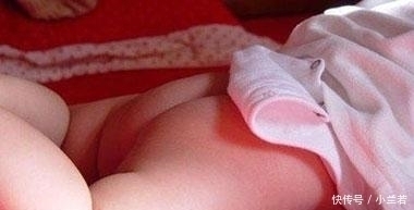 败血症|新手爸妈粗心大意, 宝宝出生不到一个月就得了败血症