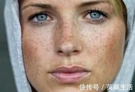 补充雌激素|雌激素分泌减少，头部显而易见！若出现3种异常，赶紧补充雌激素